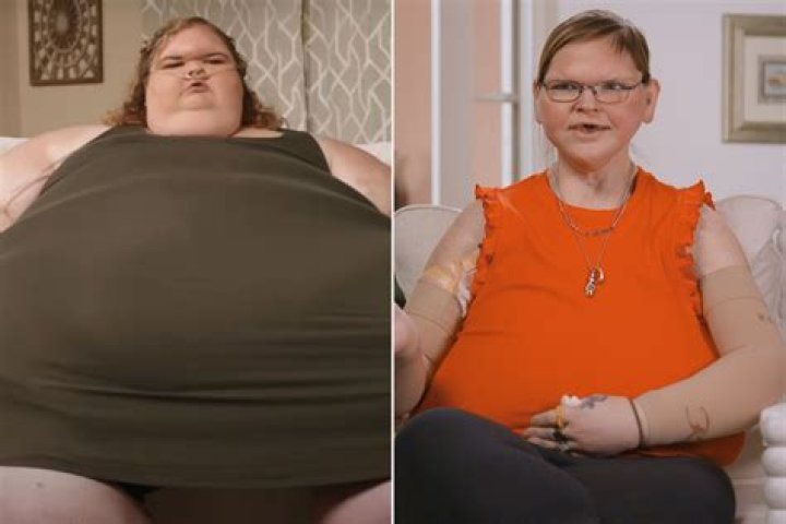 Life before and after surgery ·
