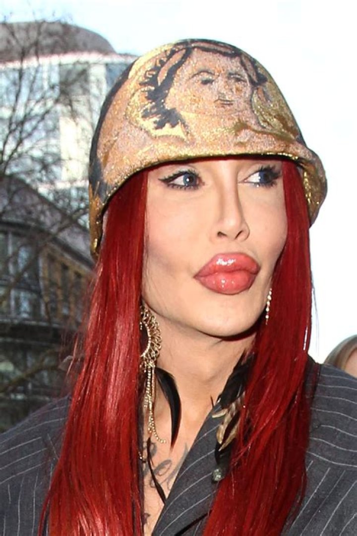Pete Burns Biography