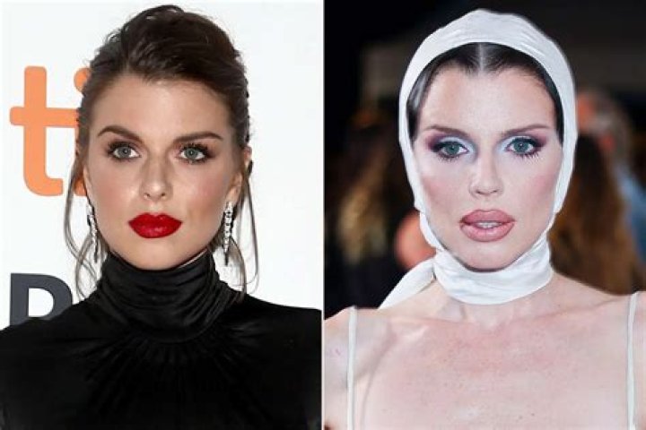 The Truth Behind Sarah Hyland Plastic Surgery