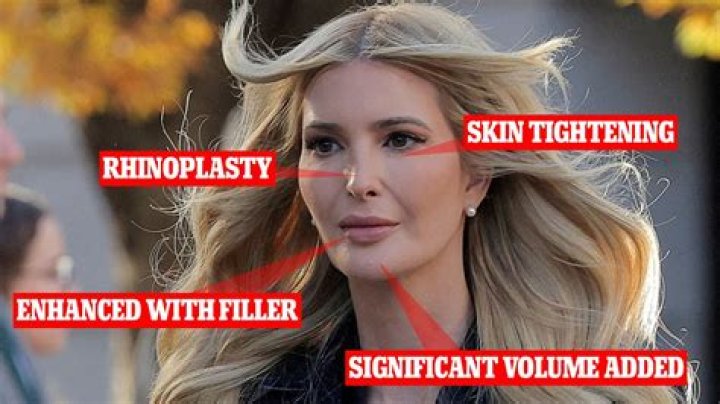 There Have Always Been Rumors That Ivanka Trump's Had Plastic Surgery